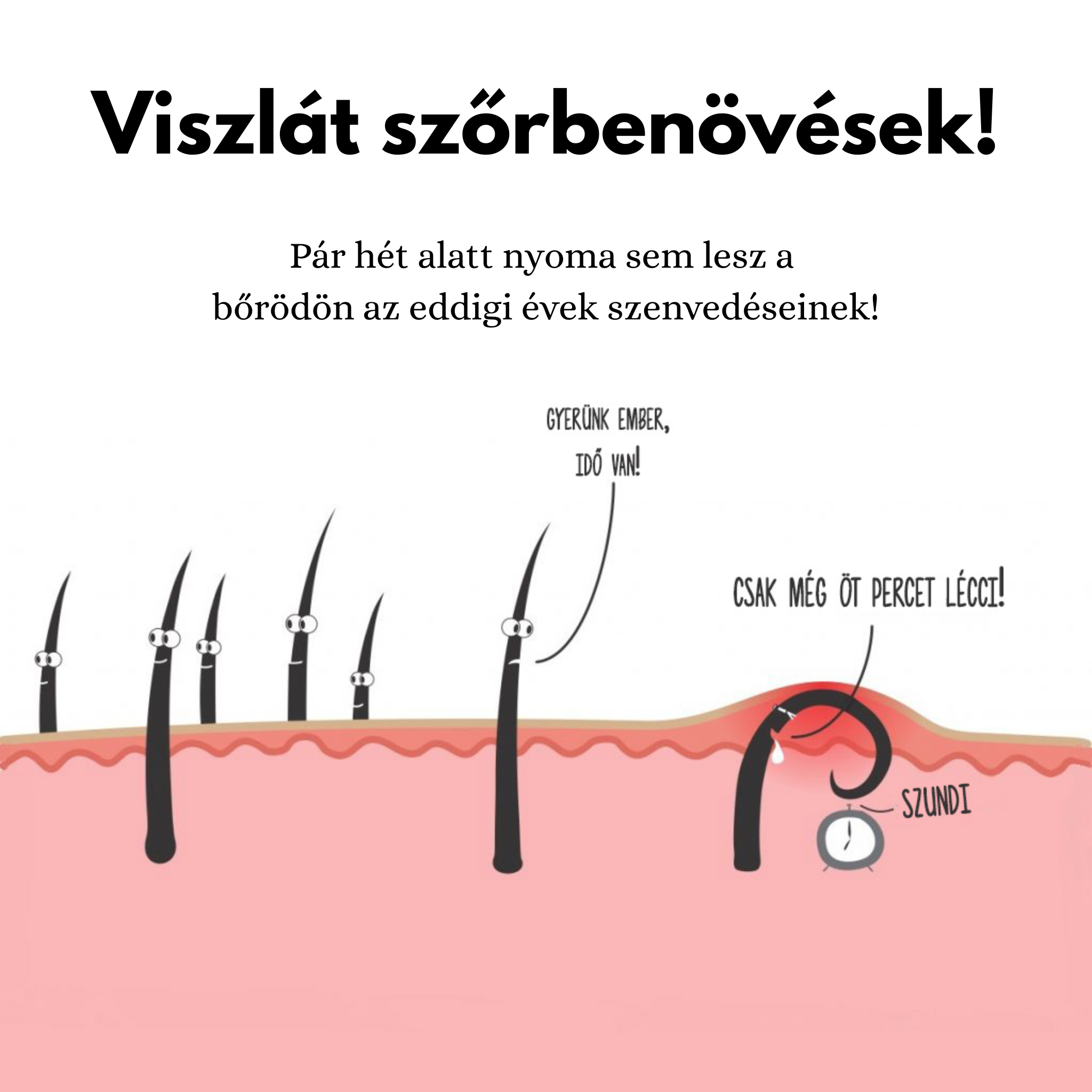 Szőrteleníts vadító profizmussal EBOOK